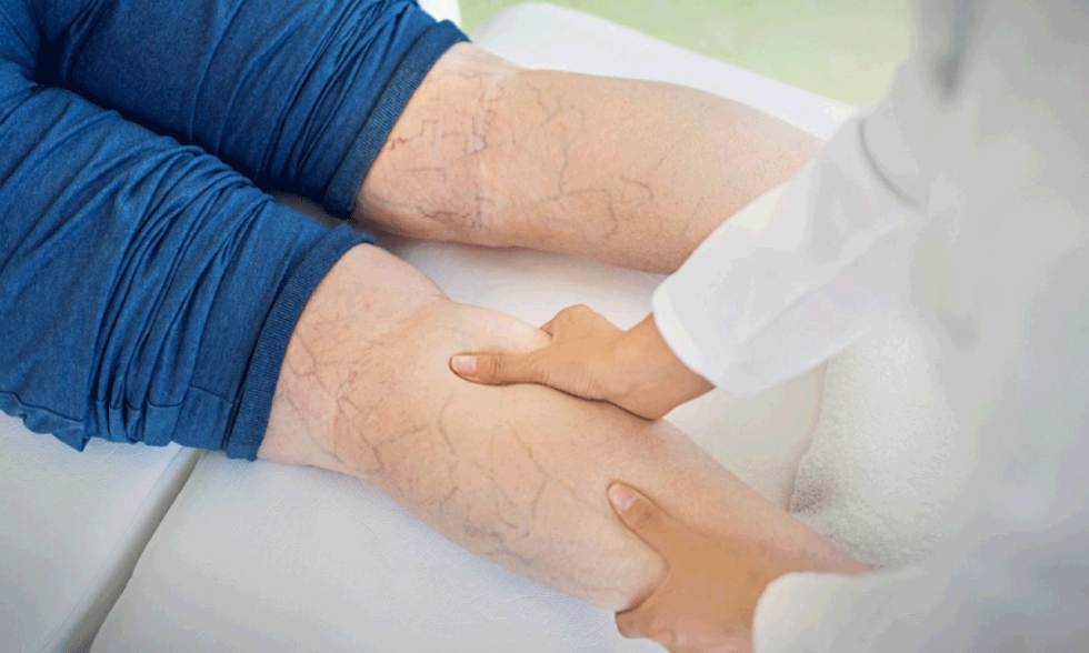 Flebologia y patologia venosa una especialidad clave para la salud vascular en America Latina