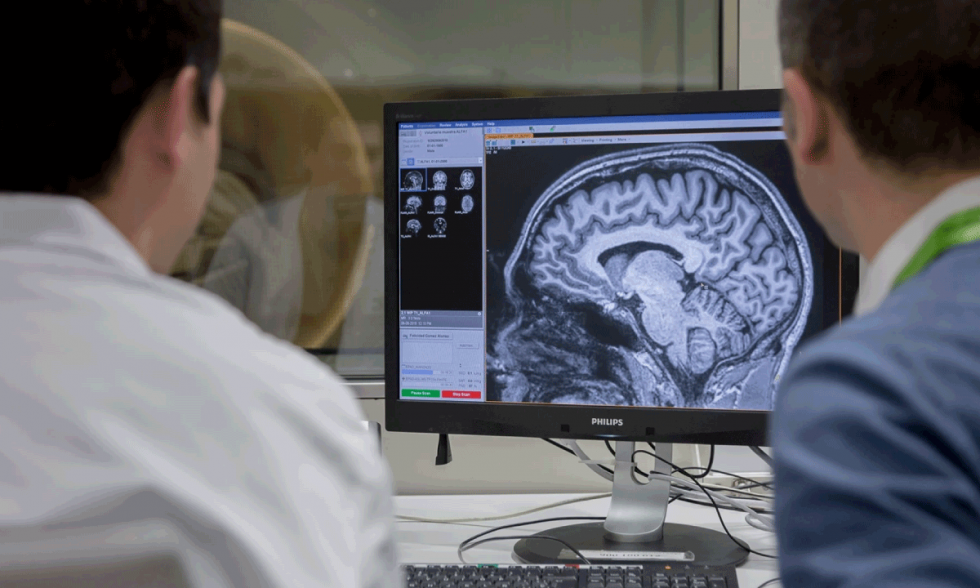 Avances esperanzadores en Alzheimer 2025 nuevas pruebas tratamientos y prevencion